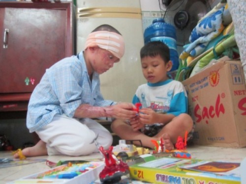 Lúc xảy ra vụ việc, chị ruột của bé Bảo, bé Nguyễn Thị Thanh Ngọc (13 tuổi, học lớp 8) đang học bài trên gác nghe tiếng kêu thét của ba mẹ chạy xuống ngã vào vũng axít cũng bị thương. Cả nhà phải nhập viện cấp cứu. Anh Tuấn, chị Xuân và hai đứa con được điều trị ở những bệnh viện khác nhau, suốt gần ba tháng không được nhìn nhau một lần